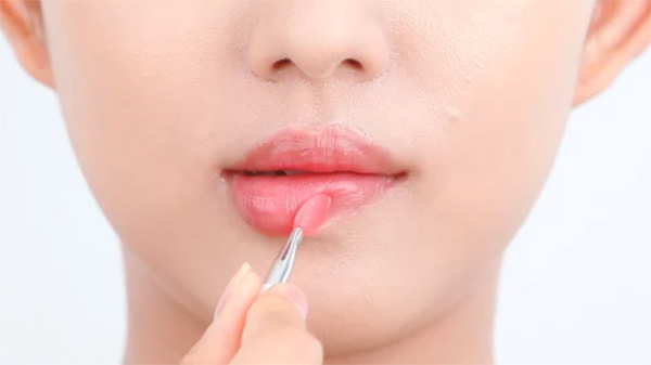 Vì sao đôi môi không hồng hào tự nhiên? Tìm hiểu nguyên nhân để khắc phục